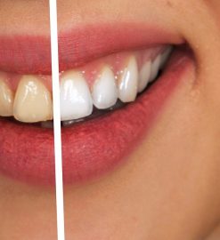 Take Care Of Your Smile: